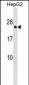 HLA-DPA1 Antibody (C-term)